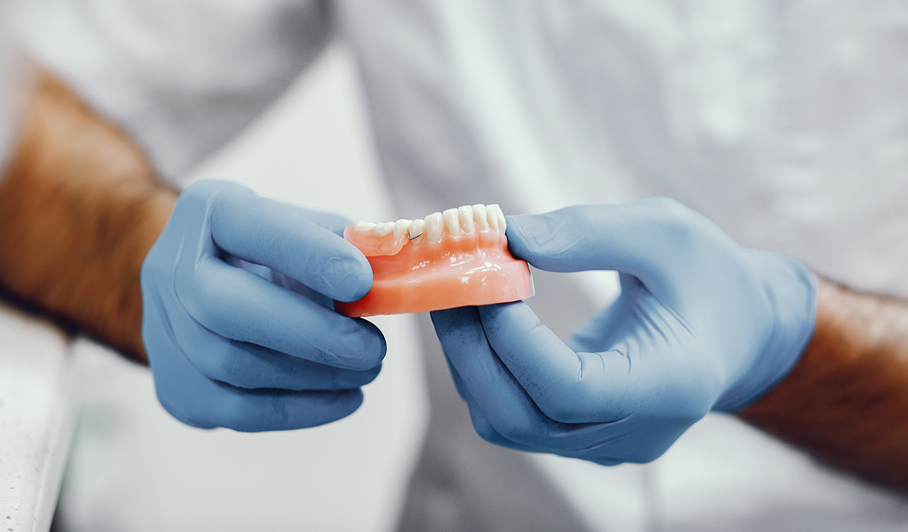 Mani di un odontotecnico presentano una protesi dentale parziale, sottolineando la cura artigianale e la precisione del laboratorio interno dello Studio Pellitteri a Bolzano